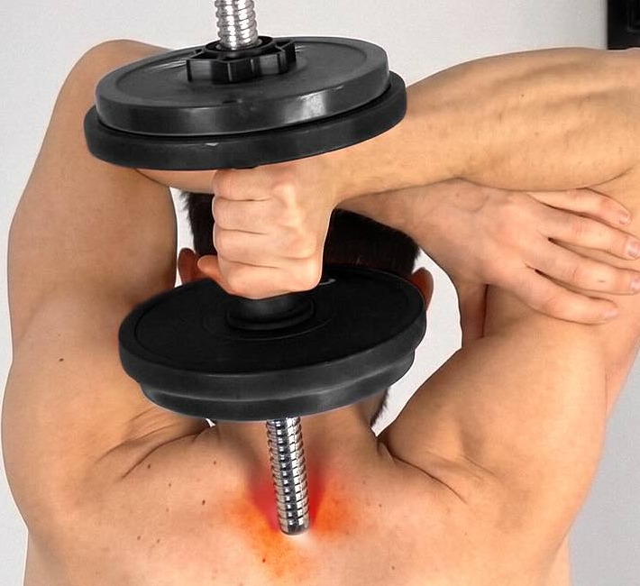 Overhead triceps extension where the threaded post of a traditional adjustable dumbbell presses into the base of the lifter's neck