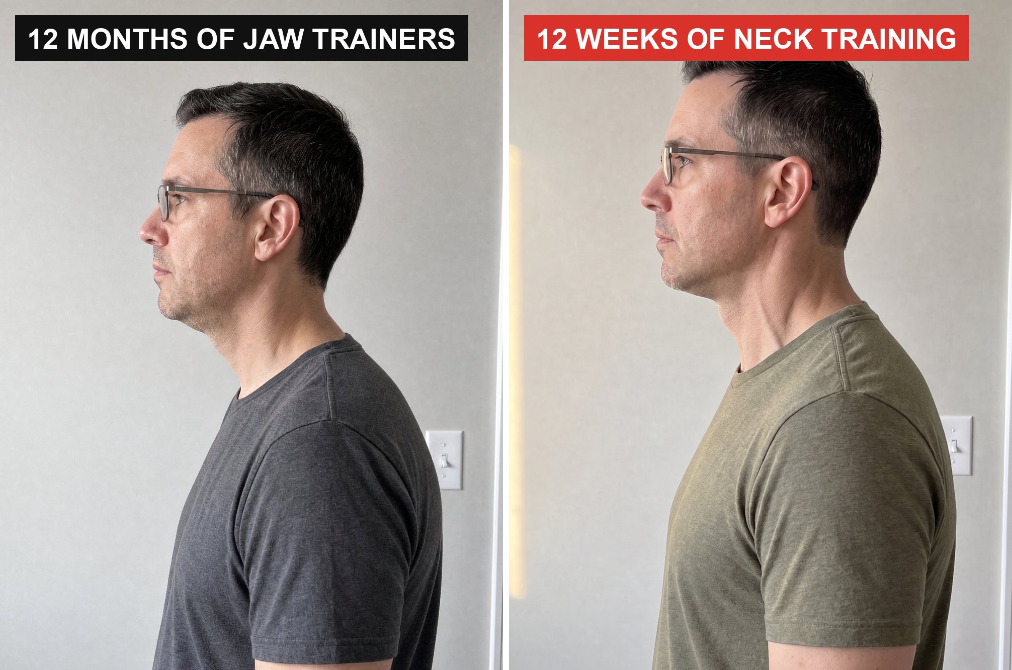 Two side-profile phone photos of the same man against a bedroom wall, labelled 12 months of jaw trainers and 12 weeks of neck training: a thin neck and a soft line under the jaw on the left, a thicker neck and a sharper jaw line on the right